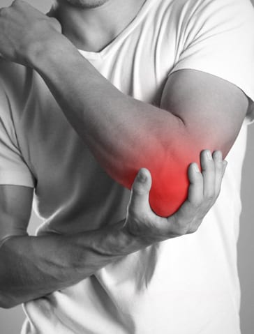 Bicep Tear at Elbow - Elbow Pain Treatment - Orthopedic Surgeon St. Louis, MO - orthopedic doctor near me - orthopedic surgeon near me - orthopedic near me - orthopedic specialist - bone doctor - dr jason browdy - dr browdy